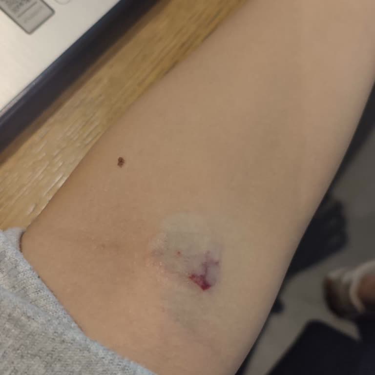 Hastanede Kan Alma İşleminde Yaşanan Sorun