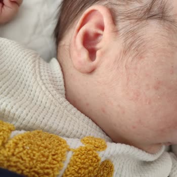 Mustela Bebek Şampuanı ile Yaşanan Sorunlar