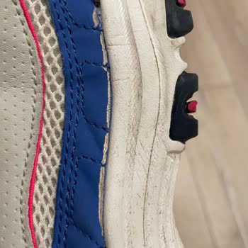 У меня разваливаются подошвы обуви Skechers, отказано в гарантии