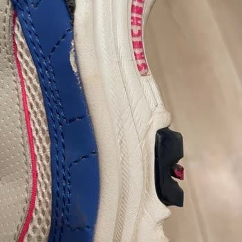 У меня разваливаются подошвы обуви Skechers, отказано в гарантии