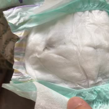 Kusurlu Yenidoğan Bebek Bezi: Sağlıksız Ürün Endişesi