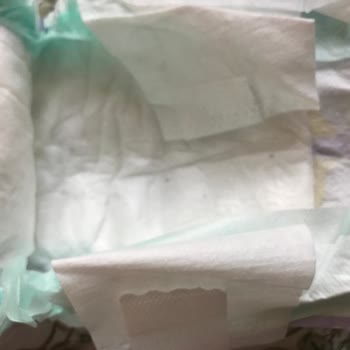 Kusurlu Yenidoğan Bebek Bezi: Sağlıksız Ürün Endişesi