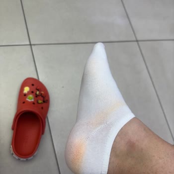 Crocs Terlik & Ayakkabı Terliklerinin Boya Sorunu Ve İade Reddi