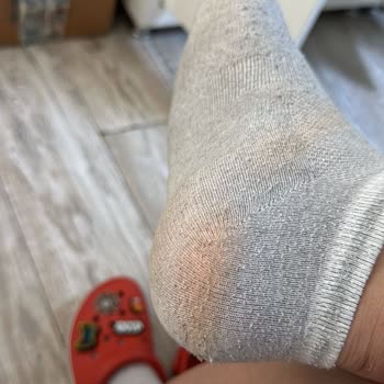 Crocs Terlik & Ayakkabı Terliklerinin Boya Sorunu Ve İade Reddi