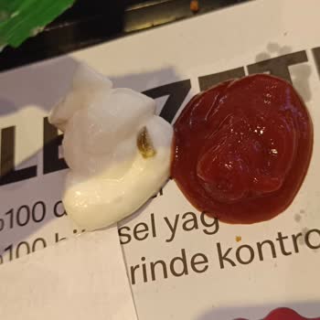 Big Mac Menüsünde Beklenmedik Yabancı Madde