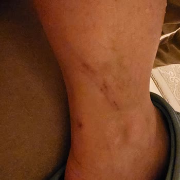 Lozan Park'ta Güvenlik İhmali: Tehlikeli Kapağın Yarattığı Risk