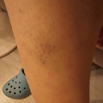 Lozan Park'ta Güvenlik İhmali: Tehlikeli Kapağın Yarattığı Risk