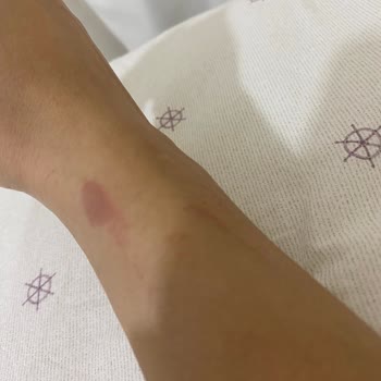 Lazer Epilasyon Paketinde Şok Fiyat Artışı ve Eksik Hizmet