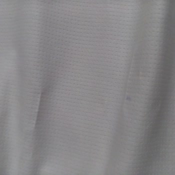 Adidas T-shirt Deformasyonu ve Müşteri Hizmetleri İlgisizliği