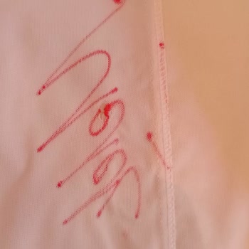 Para İadesi Bekleyen Müşteri Şikayeti