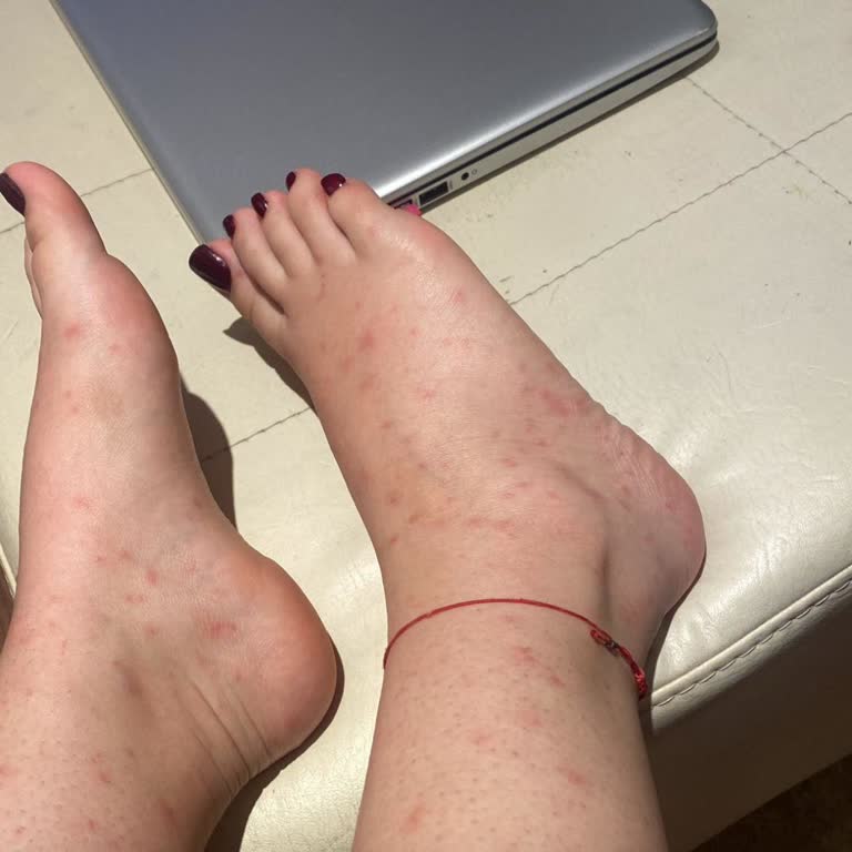 Yaşam Kalitesini Düşüren Sivrisinek Sorunu