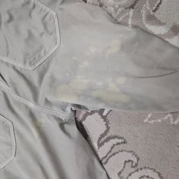 Bingo deterjan elbiselerimi mahvetti, sinirden elim titriyor