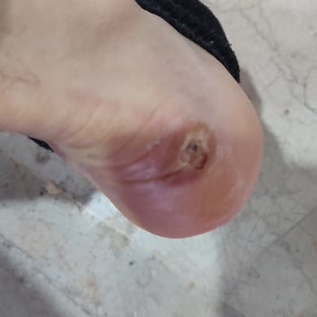 FLO'dan Aldığım Ayakkabı Ayağımı Mahvetti, İade Kabul Edilmedi