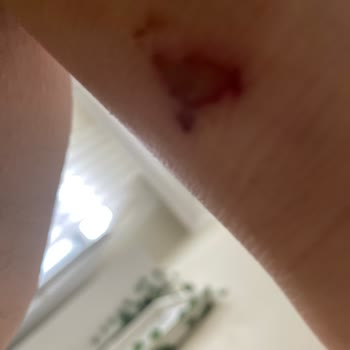 Converse Ayakkabıda Ciddi Sağlık Sorunu ve Mağaza İlgisizliği