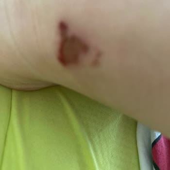 Converse Ayakkabıda Ciddi Sağlık Sorunu ve Mağaza İlgisizliği