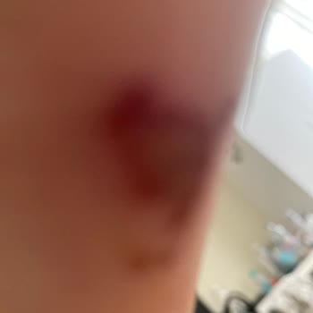 Converse Ayakkabıda Ciddi Sağlık Sorunu ve Mağaza İlgisizliği