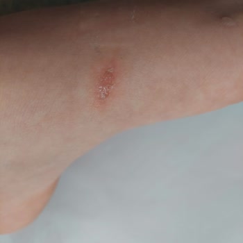 Derimod Terlikleri Ayakları Yaraladı ve İade Sorunu Yaşandı