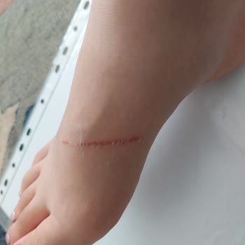 Derimod Terlikleri Ayakları Yaraladı ve İade Sorunu Yaşandı