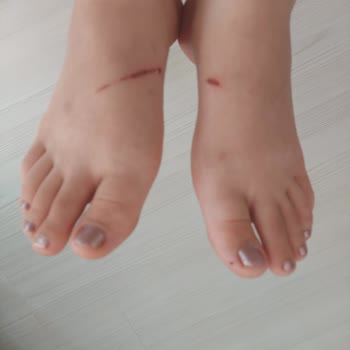 Derimod Terlikleri Ayakları Yaraladı ve İade Sorunu Yaşandı