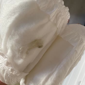 Bebek Bezinde Beklenmedik Plastik Kalıntı