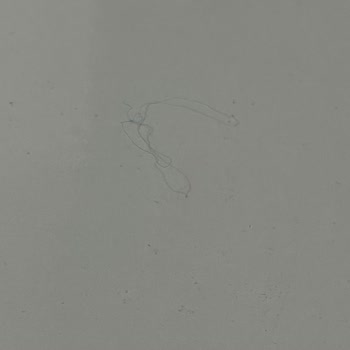 Found Wire and Hair in My Little Caesars Pizza Order