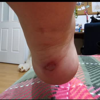 Converse Ayakkabı Ayağı Vurdu, İade Talebi