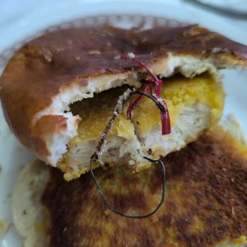 Hamburger Köftesinden Çıkan Metal Tel Şoku