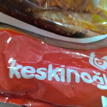 Hamburger Köftesinden Çıkan Metal Tel Şoku