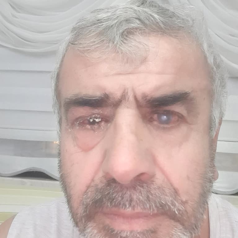 Hastane Temizlik ve Yemek Hizmetlerinde Yetersizlik