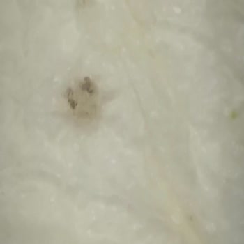 Bebek Bezi Skandalı: Böcekli Sleepy Külot Bezler