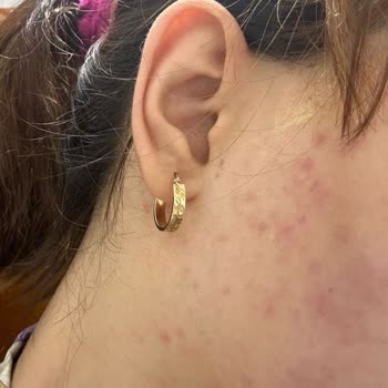 Darıca For You Güzellik Salonu Şikayetim