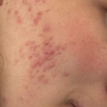 Darıca For You Güzellik Salonu Şikayetim