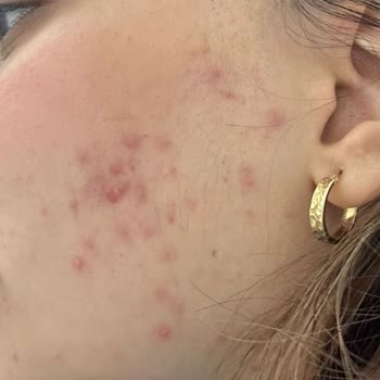 Darıca For You Güzellik Salonu Şikayetim