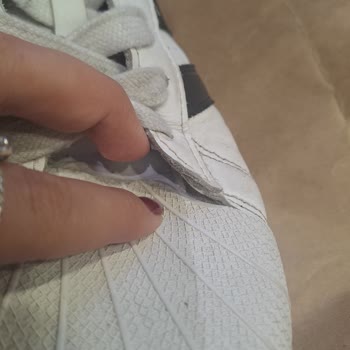 Adidas Ayakkabının Anormal Aşınması ve Mağaza Reddi