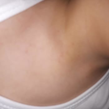 Alerjik Reaksiyon ve İlgisiz Müşteri Hizmetleri