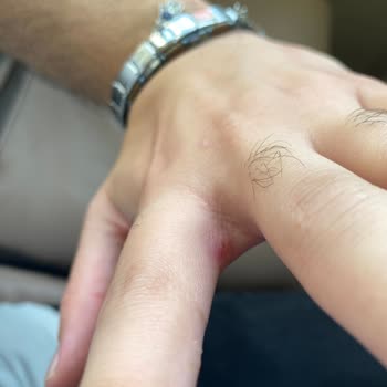 İstanbul Başkent Hastanesi Hizmetinde Eksiklik Ve İletişim Sorunu!