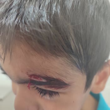 Acil Müdahale Ücreti ve Evrak Sorunu