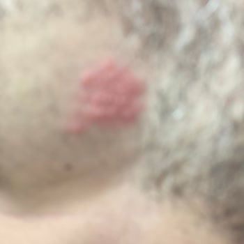 Küçükköy Hamam 365 Hijyen Sorunları Ve Sağlık Riskleri!