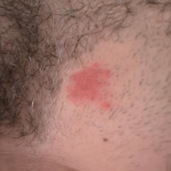 Küçükköy Hamam 365 Hijyen Sorunları Ve Sağlık Riskleri!