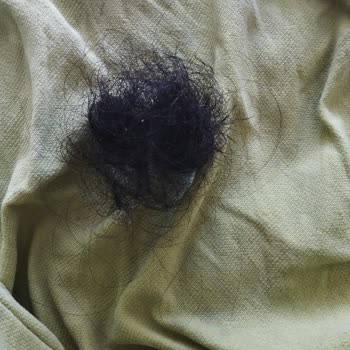 Johnson's Şampuanı İle Yaşanan Ciddi Sağlık Sorunları