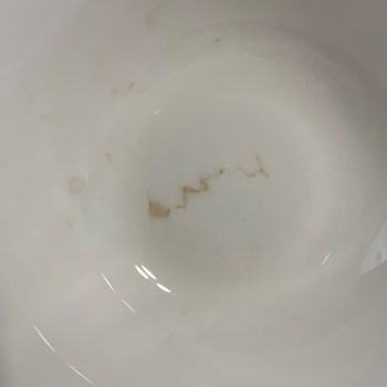 Yemek Takımında Beklenmedik Lekeler ve Müşteri Hizmetleri Sorunu