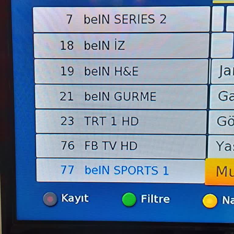 Digiturk Müşteri Hizmetleri Ve Eksik Kanal Sorunu
