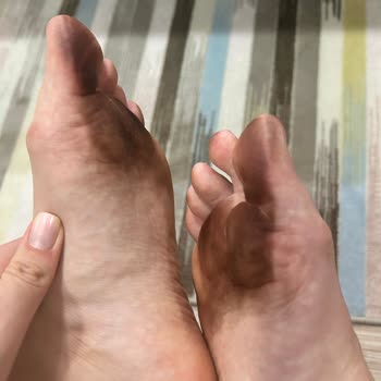 Vakko Sneaker'ın Sağlık Tehlikesi: Acil Çözüm Bekliyorum