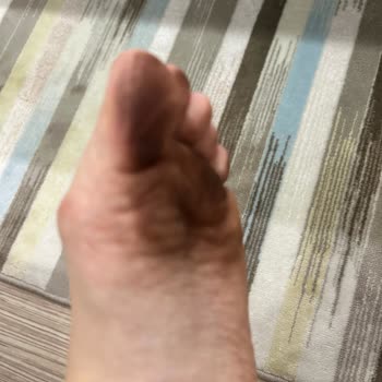 Vakko Sneaker'ın Sağlık Tehlikesi: Acil Çözüm Bekliyorum
