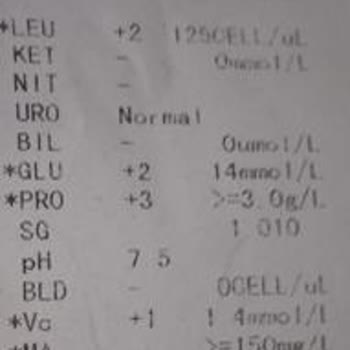 Exclusion Şikayeti!