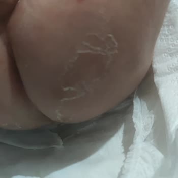 Sleepy Bio Naturel Bebek Bezi Hayal Kırıklığı