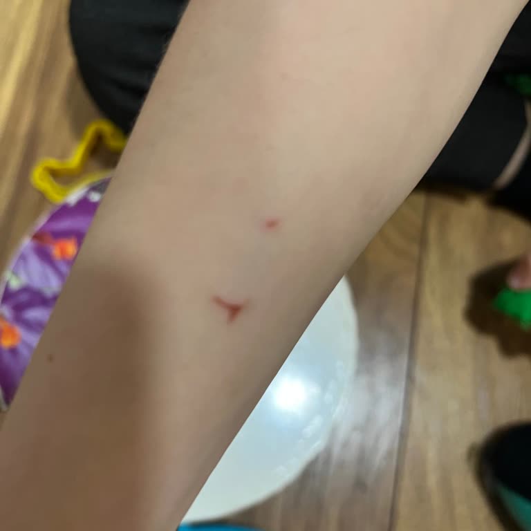 Tad Preschool Bağlıca Çocuğuma Verilen Zarar!