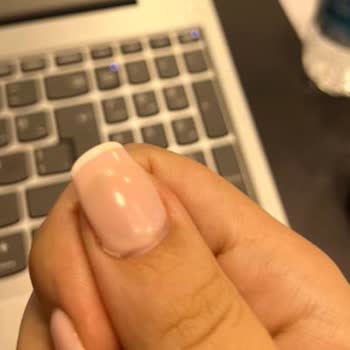 Protez Tırnak Hizmetinde Estetik Sorunlar