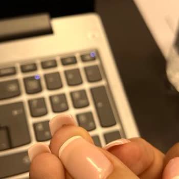 Protez Tırnak Hizmetinde Estetik Sorunlar