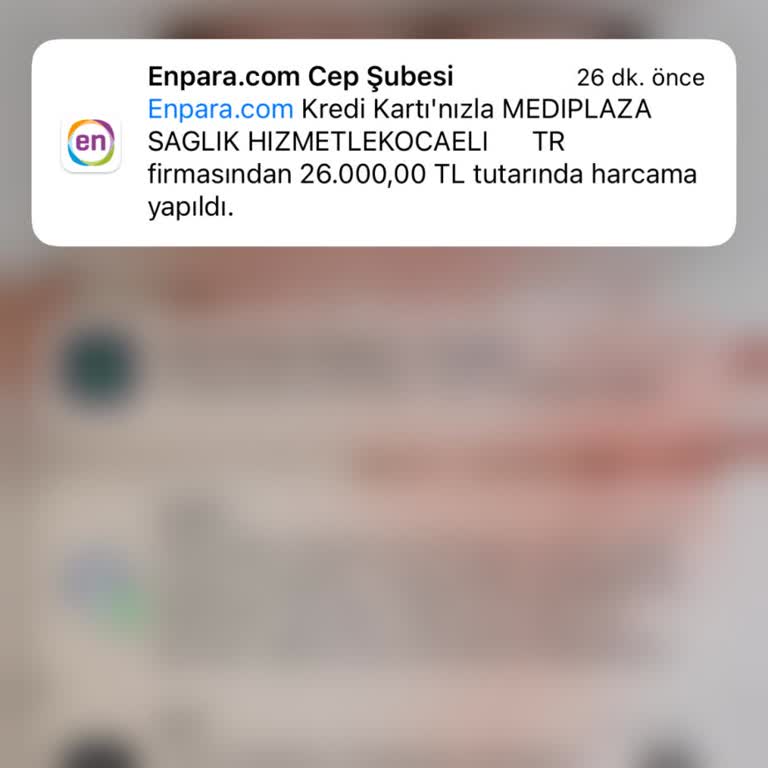 Şeffaf Olmayan Ücret Politikası Ve Son Dakika Sürprizleri